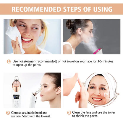 Vacuum Electric Blackhead Remover Cleaner - MyGadgets411